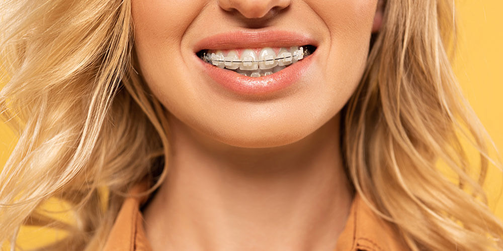 Clear Braces Southcentre, Seton and Okotoks